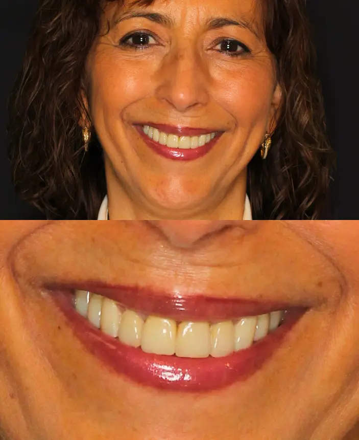 After Image