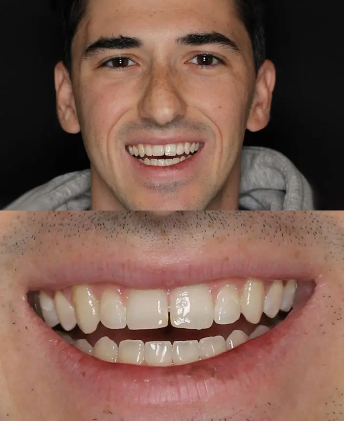 Before Image