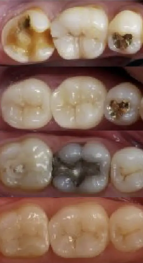 Dental Technology