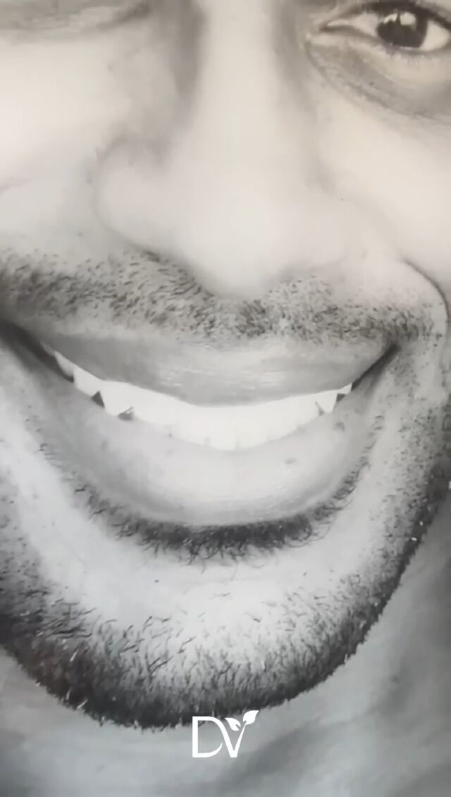 See the artistry and dedication behind every beautiful, confident smile we create. At #Dentalvana, it’s not just about dental treatments, it’s about making you feel great every time you smile! 🌟

💬 Drop a comment if you’d like to see more behind-the-scenes moments of how we create those stunning smiles!

📍 Located in Miami – Ready for your smile transformation? 
Book your appointment today!

12417 Biscayne Blvd, North Miami, FL 33181
(786) 516-2882

#Dentalvana #MiamiDentist #CosmeticDentistMiami #SmileMakeover #VeneersMiami #DentalStudio #PatientExperience #SmileJourney #HealthyTeeth #MiamiLiving